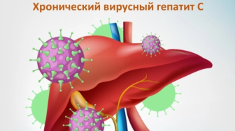 Вирусный гепатит С: что важно знать